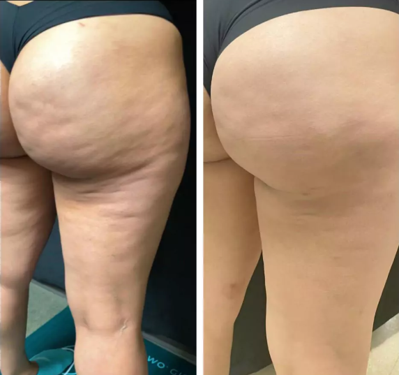 Smoother-looking skin