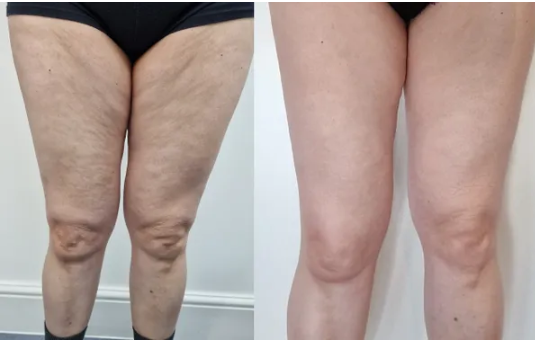 Visible results in weeks